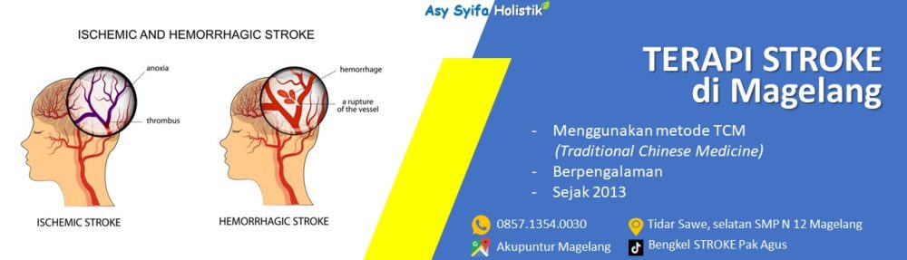 TERAPI STROKE MAGELANG – WA: 0857.1354.0030